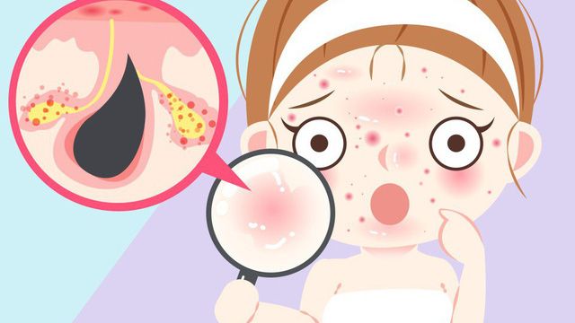 Giải cứu làn da ngày hè: 4 vấn đề phổ biến và cách khắc phục hiệu quả