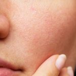 5 bước chăm da từ trong ra ngoài giúp thu nhỏ lỗ chân lông, tạm biệt bóng dầu
