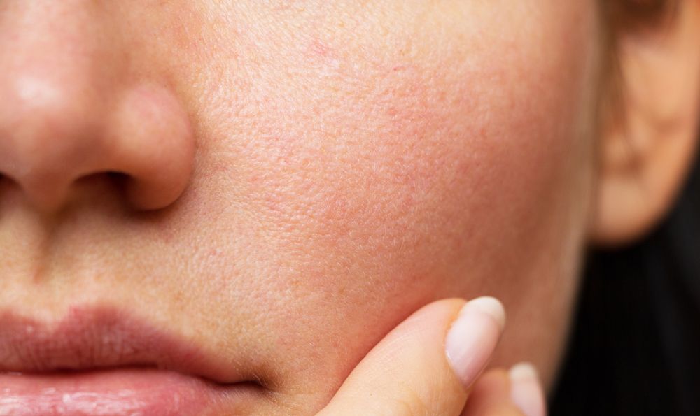5 bước chăm da từ trong ra ngoài giúp thu nhỏ lỗ chân lông, tạm biệt bóng dầu