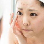 Dùng nhiều mỹ phẩm mà da vẫn xấu, vì sao?