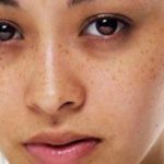 Da kém sắc ngày lạnh và cách cải thiện chỉ trong vài bước