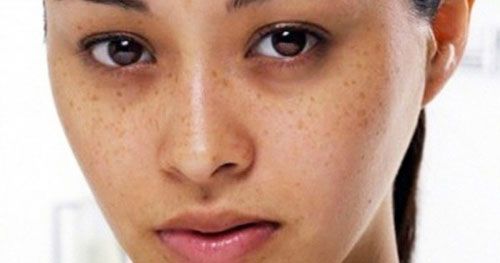 Da kém sắc ngày lạnh và cách cải thiện chỉ trong vài bước