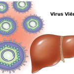 Những hiểu lầm phổ biến về viêm gan B khiến nhiều người chủ quan