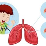 Viêm phổi ở trẻ: Nhận biết sớm để tránh biến chứng nặng