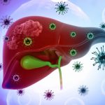 Phân biệt viêm gan virus A, B, C, D, E: Loại nào nguy hiểm nhất?