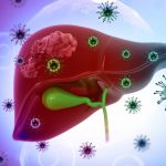 Viêm Gan B Và C Khác Nhau Thế Nào? Những Điều Cần Biết Để Bảo Vệ Lá Gan