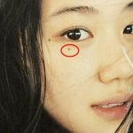 Nốt ruồi ở đâu khiến vận khí suy, tình cảm mệt mỏi? Đây là 3 vị trí ai cũng nên biết