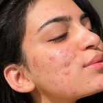 Da nhiều khuyết điểm, lỗ chân lông to: Chuyên gia cảnh báo 5 loại sản phẩm nên tránh xa ngay