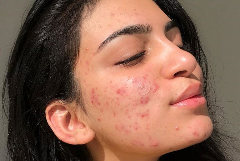 Da nhiều khuyết điểm, lỗ chân lông to: Chuyên gia cảnh báo 5 loại sản phẩm nên tránh xa ngay