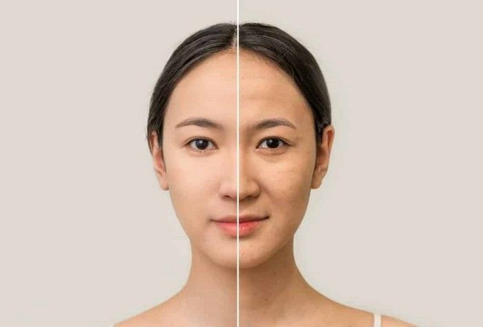 Bổ sung collagen đúng cách để cải thiện làn da lão hóa