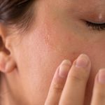 Mùa hè da đổ dầu liên tục: Bí quyết giữ lỗ chân lông luôn thông thoáng