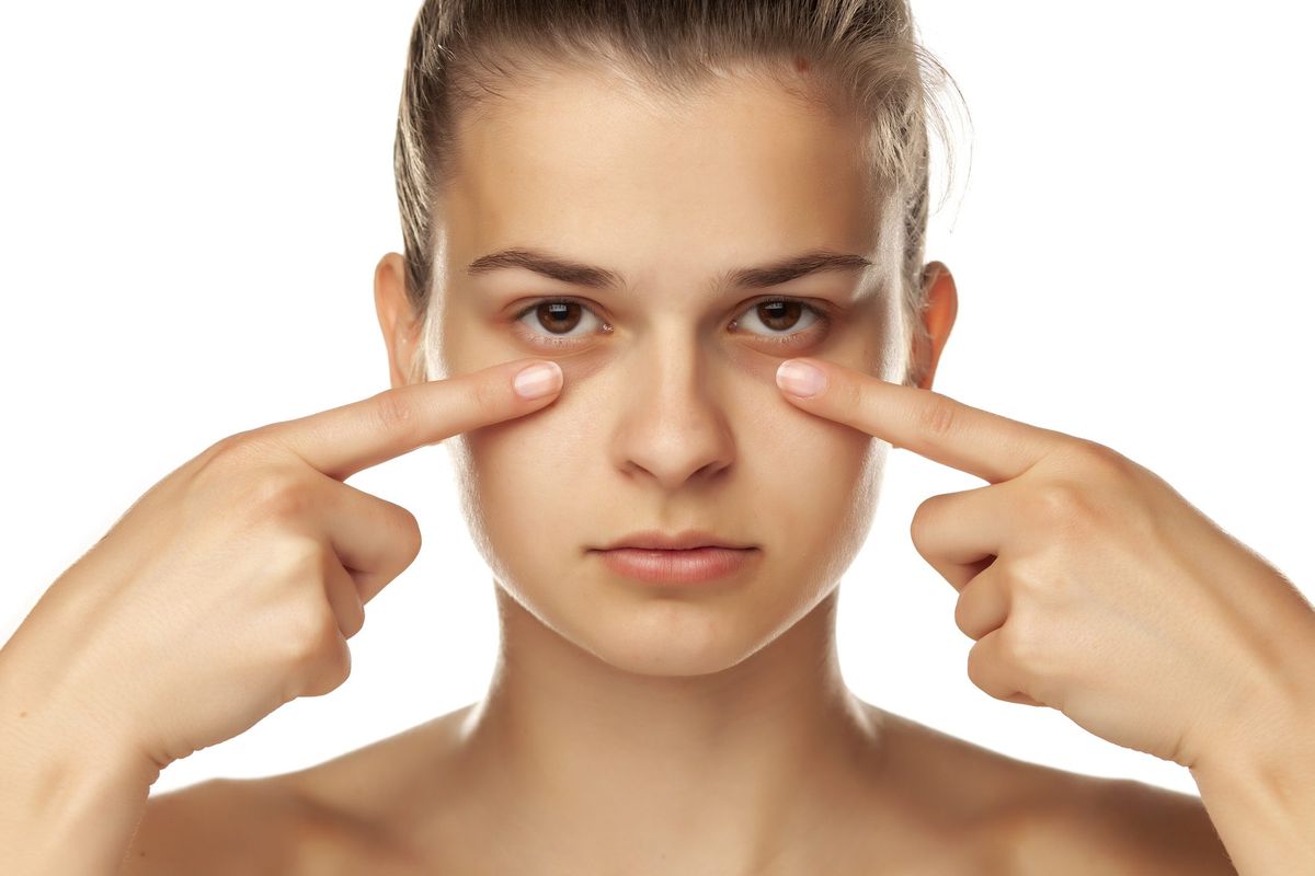 Vì sao bôi kem mắt mãi vẫn không hết quầng thâm?